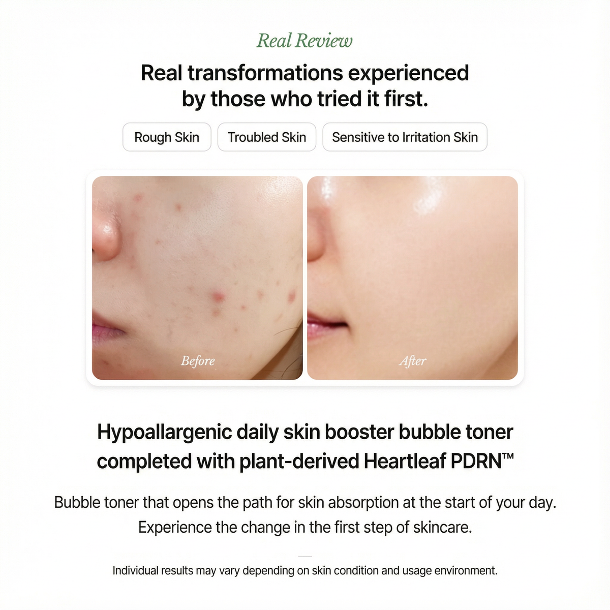 [NEW] Suelo Reju Calming PDRN Bubble Toner