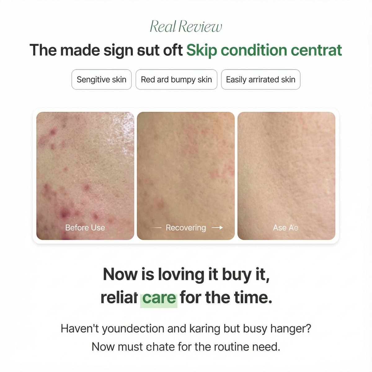[NEW] Suelo Reju Calming PDRN Cream